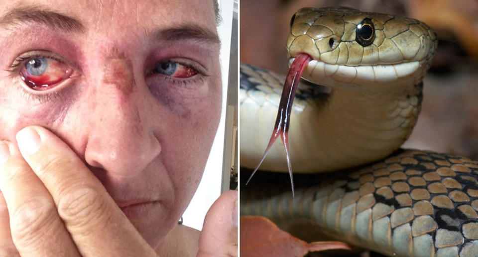 Mission Beach snake catcher Sue Ambler said she was strangled recently by a python and nearly killed trying to remove the serpent from a tree. Source: Facebook/ Sue Ambler and Getty Images (File pic)