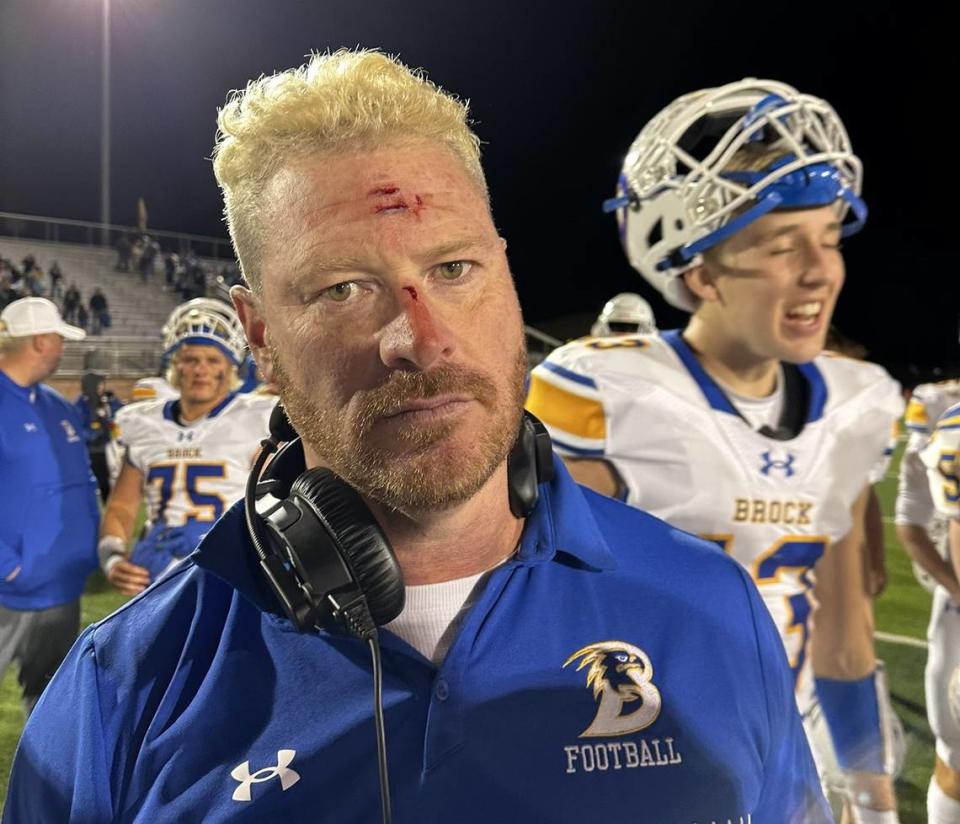 Brock head coach Billy Mathis shows off his lacerations after head butting Carson Finney following Finney’s interception that sealed the win for the Eagles over Paradise in a Class 3A Division 1 state quarterfinal on Friday, December 1, 2023 at Ram Stadium in Mineral Wells, Texas.