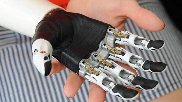 Рука разбор. Бионический протез руки bebionic. Бионический протез пальца руки. Протез бионический для пальцев кисти. Mehands бионический протез руки.