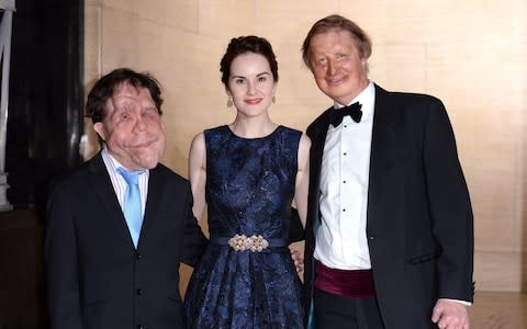 Adam Pearson, Michelle Dockery and James Partridge, founder of Changing Faces attend the Changing Faces Gala Dinner held at Bloomsbury Ballroom on March 27, 2014 in London - Credit: Karwai Tang/WireImage