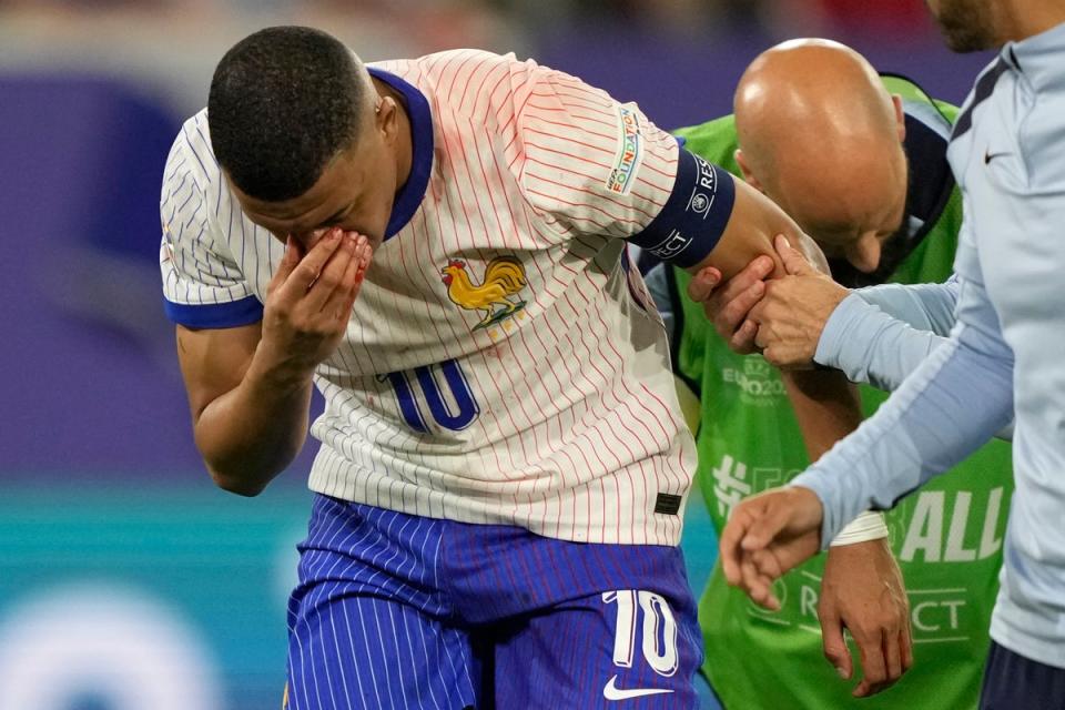 Bloodied: Kylian Mbappe suffered a gruesome facial injury as France beat Austria (AP)