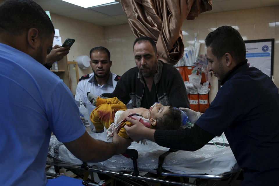 Palestinian child wounded in the Israeli bombardment of the Gaza Strip is brought to al Aqsa Hospital on Deir al Balah, Gaza Strip, Friday, Dec. 1, 2023. (AP Photo/Adel Hana)