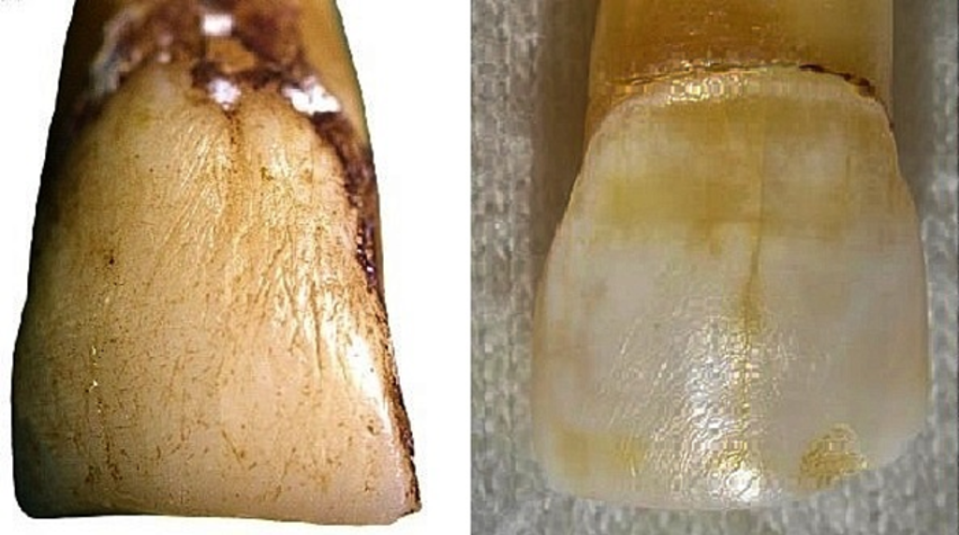 Japanese macaques teeth