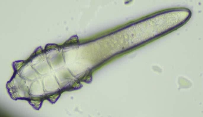 蠕形蟎蟲大量繁殖造成眼睛搔癢、結膜出血出現乾眼症，嚴重甚至會影響視力。(圖／中山醫大附醫提供)