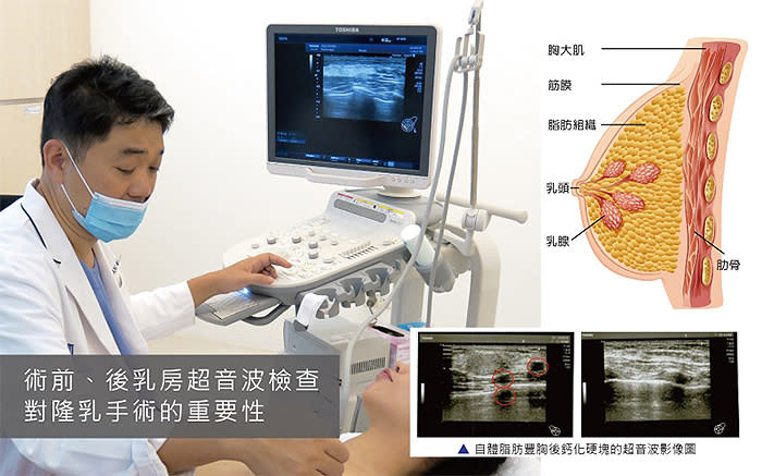 【隆乳安全】術前乳房超音波檢查評估+術後定期追蹤照護是張大力院長對隆乳安全的堅持，10月為國際乳癌防治月，東京風采張大力院長提醒女性:「追蹤乳房的健康，並非只有隆乳後的女性需要，一般女性皆需有定期檢查乳房的觀念」。