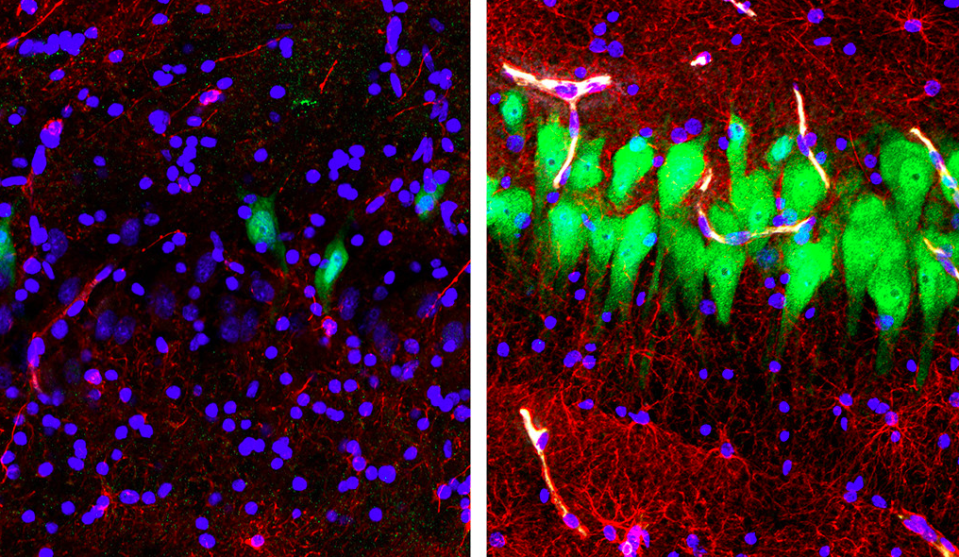 A pig’s brain left untreated for 10 hours after death (left) compared to a ‘revived’ brain (right). Source: Yale University