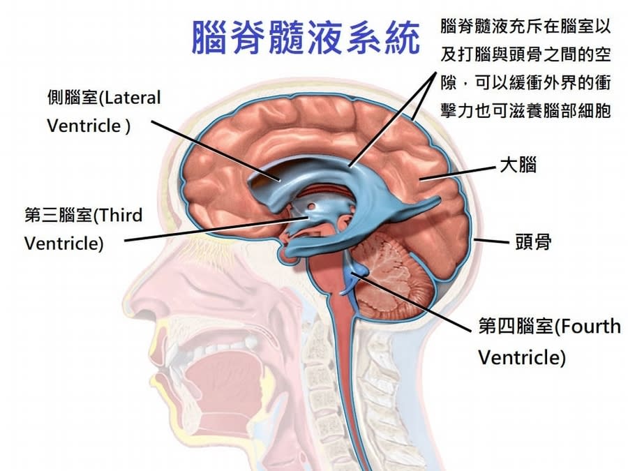 什麼是常壓性水腦症？