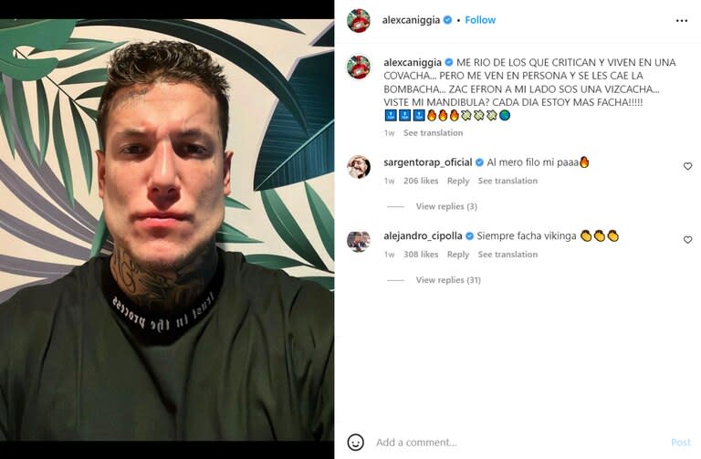 Alex Caniggia respondió a quienes lo criticaron por su nueva mandíbula