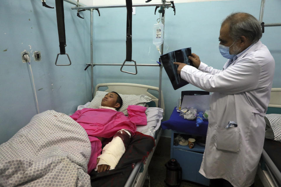 A doctor looks at an x-ray of a man being treated at a hospital after a deadly attack at Kabul University, in Kabul, Afghanistan, Monday, Nov. 2, 2020. The brazen attack by gunmen who stormed the university has left many dead and wounded in the Afghan capital. The assault sparked a hours-long gunbattle. (AP Photo/Rahmat Gul)