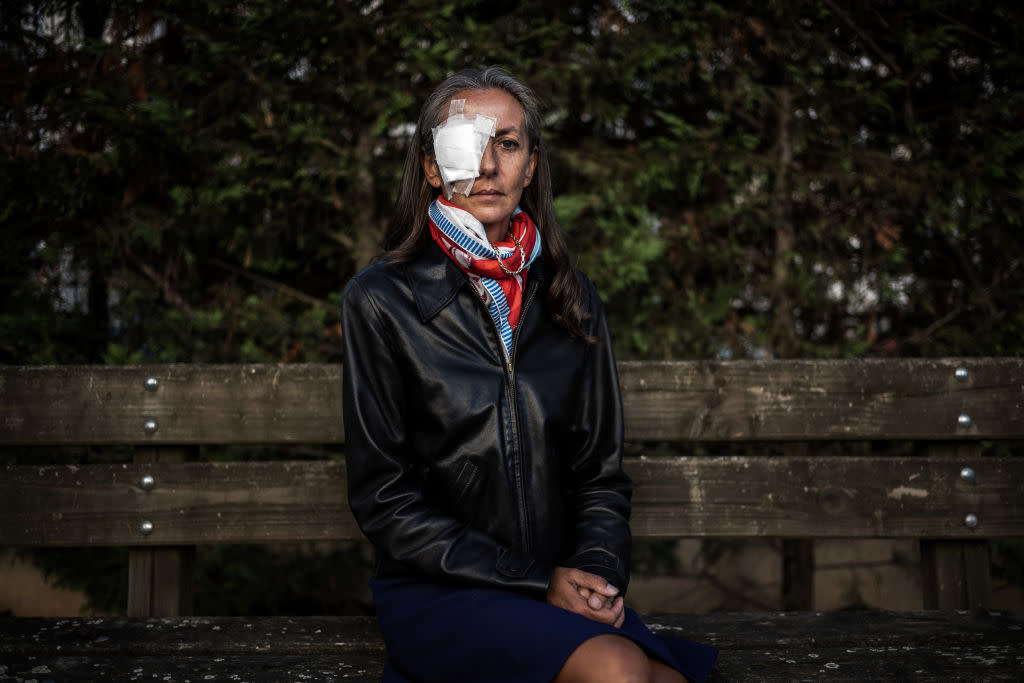 Corine Remande, 49, is taking legal action against Ryder Cup organizers after being struck by a Brooks Koepka tee shot. (Getty Images)