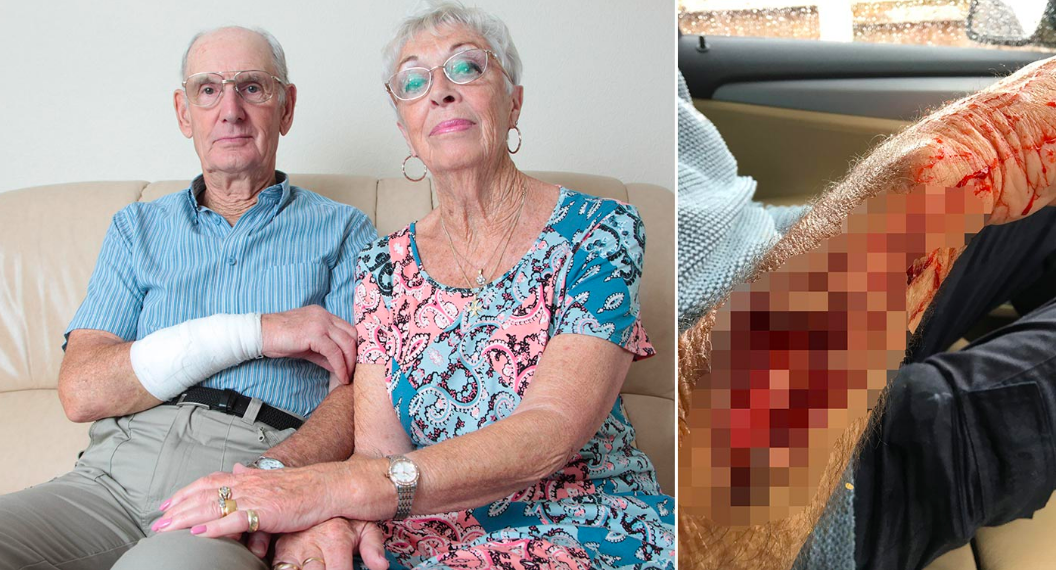 The pensioner had some of his arm torn off during the savage attack. (Caters)