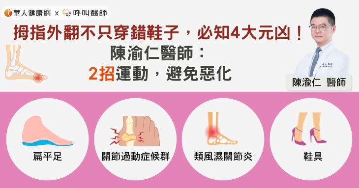 拇趾外翻不只穿錯鞋子，必知4大元凶！陳渝仁醫師：2招運動，避免惡化