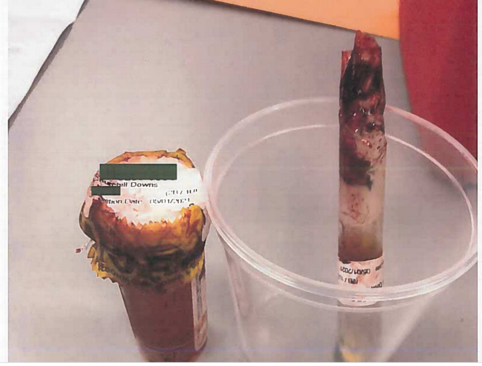 A photo of the broken blood sample, right, and potentially contaminated primary urine sample from Medina Spirit, from the court records in Bob Baffert’s case in Franklin Circuit Court. According to an email to Baffert’s attorney the bottom of the tube shattered in transit.