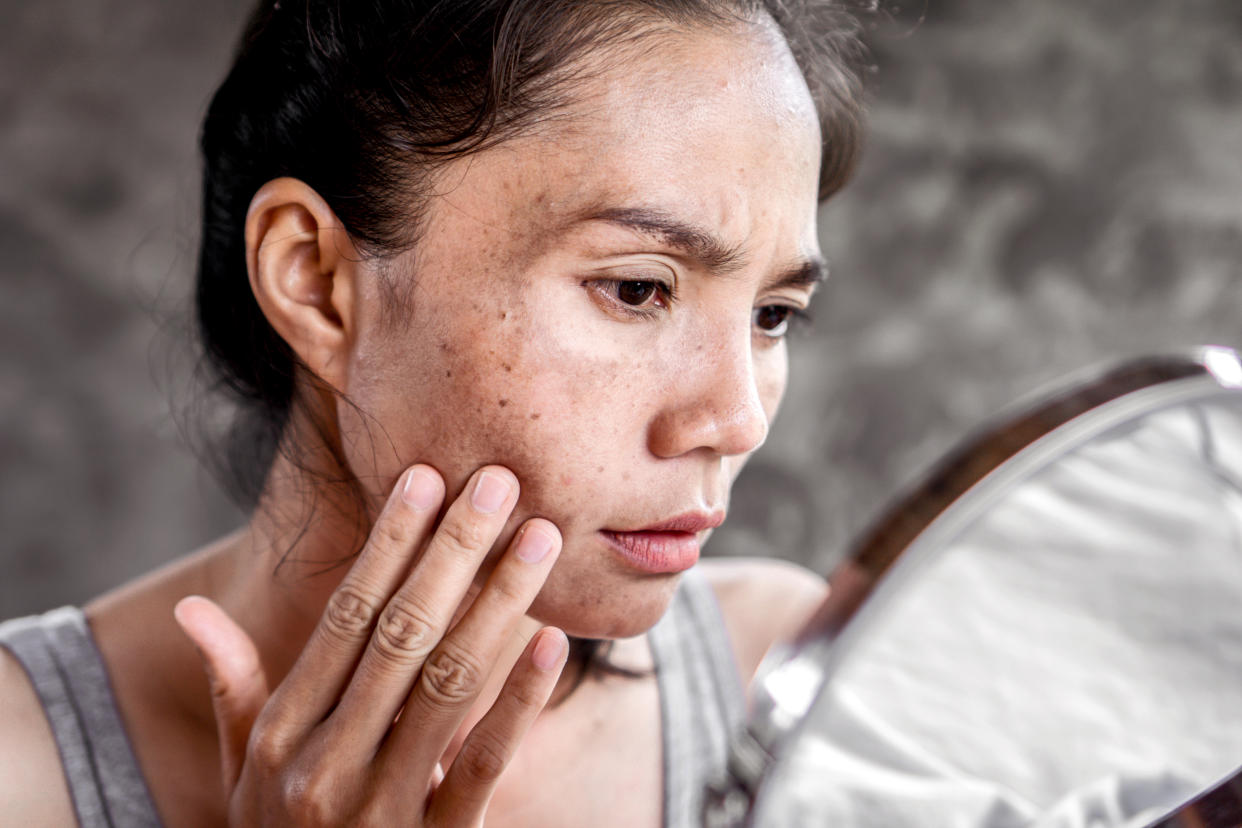 Woman checking face for sun damage