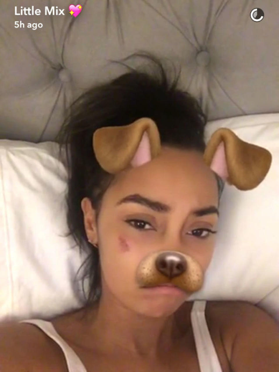 Leigh-Anne shared a snap of her cut face after news of “restaurant attack” (Copyright: Snapchat)