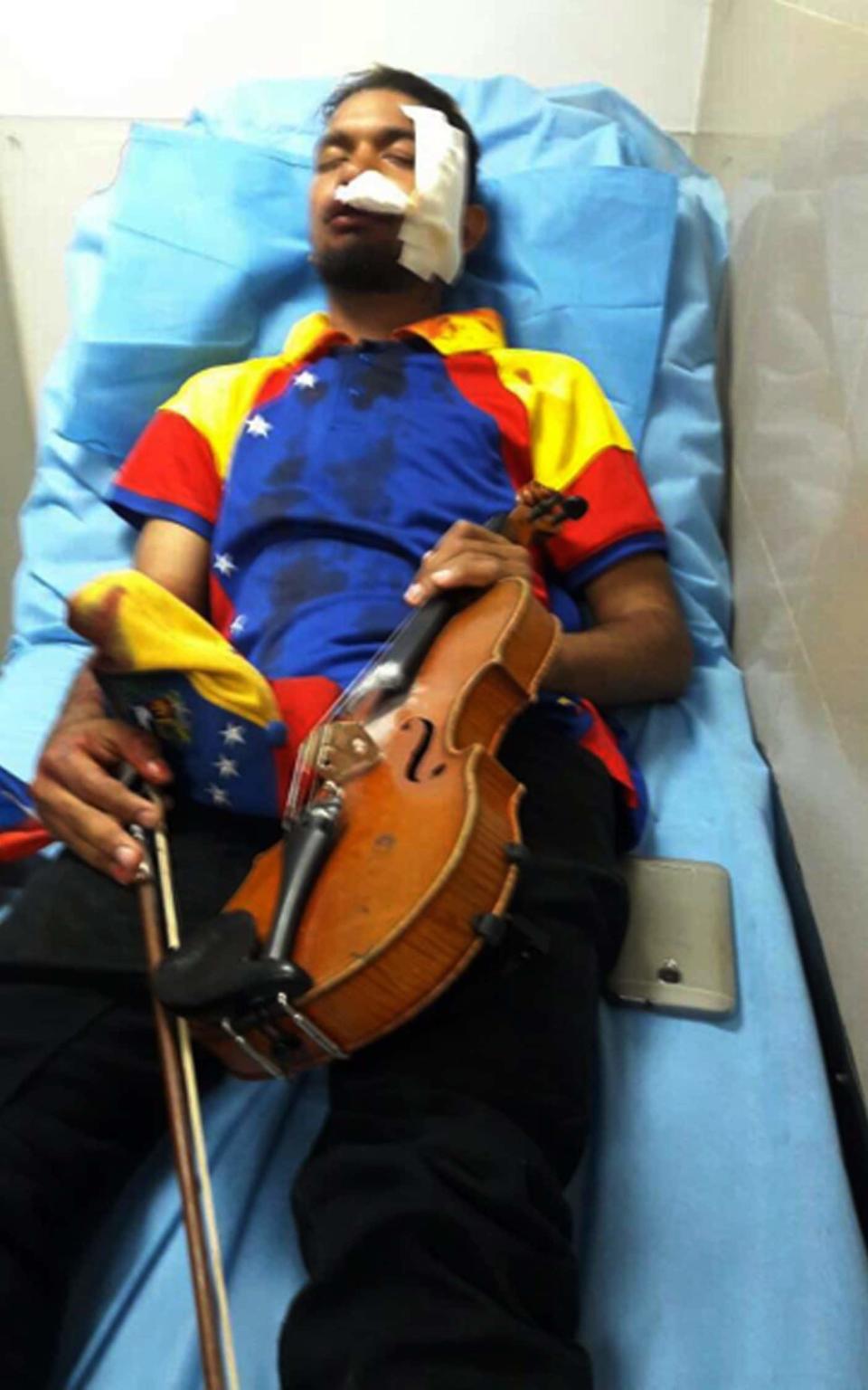 Wuilly Arteaga lying in a hospital bed in Caracas after he was injured during a protest - Credit: Robert Carmona-Borjas via AFP