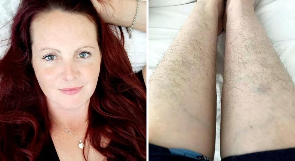 Woman didn't shave legs for six months. (SWNS)