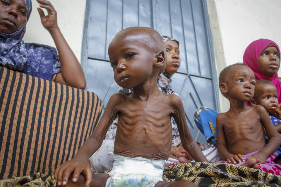 A malnourished two year-old sits by his mother, left, who was recently displaced by drought, at a malnutrition stabilization center run by Action against Hunger, in Mogadishu, Somalia Sunday, June 5, 2022. Elections, coups, disease outbreaks and extreme weather are some of the main events that occurred across Africa in 2022. Experts say the climate crisis is hitting Africa “first and hardest.” Kevin Mugenya, a senior food security advisor for Mercy Corps said the continent of 54 countries and 1.3 billion people is facing “a catastrophic global food crisis” that “will worsen if actors do not act quickly.” (AP Photo/Farah Abdi Warsameh)