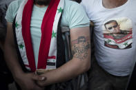 An Injured Syrian soldier with a tattoo of President Bashar Assad as they celebrate at Omayyad Square, in Damascus, Syria, Thursday, May 27, 2021. (AP Photo/Hassan Ammar)