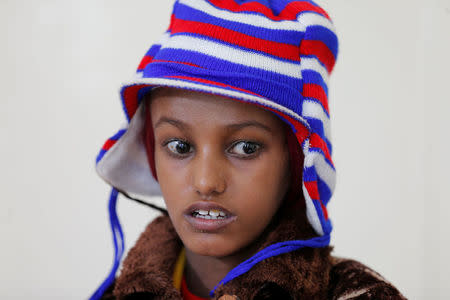 Saida Ahmad Baghili, 18, who has been affected by severe malnutrition, sits at a hotel in Sanaa, Yemen December 6, 2016. REUTERS/Khaled Abdullah