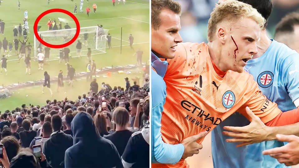 Melbourne City goalkeeper Tom Glover was left with a cut on his face after being assaulted by a group of spectators during the A-League derby against Melbourne Victory. Image: Twitter/Getty
