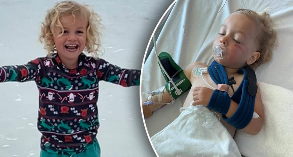 Left: Toddler Parker Galloway playing in water. Right: Parker Galloway lying in hospital bed with broken bones. 