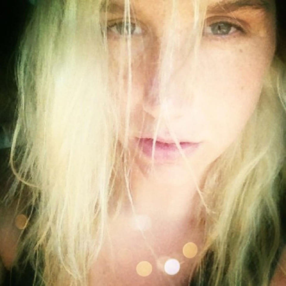 Ke$ha