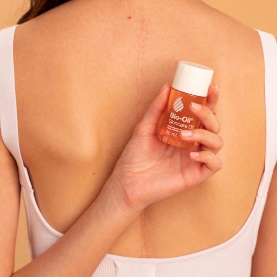 If you're dealing with stretch marks or an uneven skin tone, this oil can be a big help. Reviewers also say it absorbs into the skin quickly so you won't feel too greasy.<br /><br /><strong>Promising review:</strong> "If I could give this product more than five stars, I would. <strong>Immediately after the first application my skin felt so much better. As I was massaging the oil into my skin I could feel the peeled skin coming off. My face wasn't feeling itchy anymore, and the dryness disappeared immediately. It only took two applications of this oil to make my skin heal almost completely.</strong> Now I use it on a daily basis, two times a day (morning and night) and <strong>my skin has never felt so healthy</strong>. This is the best product I've ever tried, and trust me, I've tried A LOT." &mdash; <a href="https://amzn.to/3gyZxUy" target="_blank" rel="noopener noreferrer">Amazon Customer</a><br /><br /><strong>Get it from Amazon for <a href="https://amzn.to/2PeZge9" target="_blank" rel="noopener noreferrer">$8.92+</a> (available in five sizes). </strong>