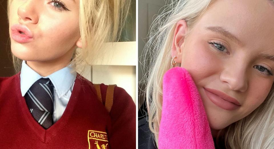 Chloe Eggerton says her experiences of being bullied for her acne inspired her to start a skincare business. (Chloe Eggerton/SWNS)