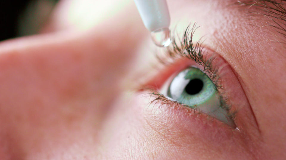 Close-up of person using eyedrops. (mputsylo / Getty Images/iStockphoto)