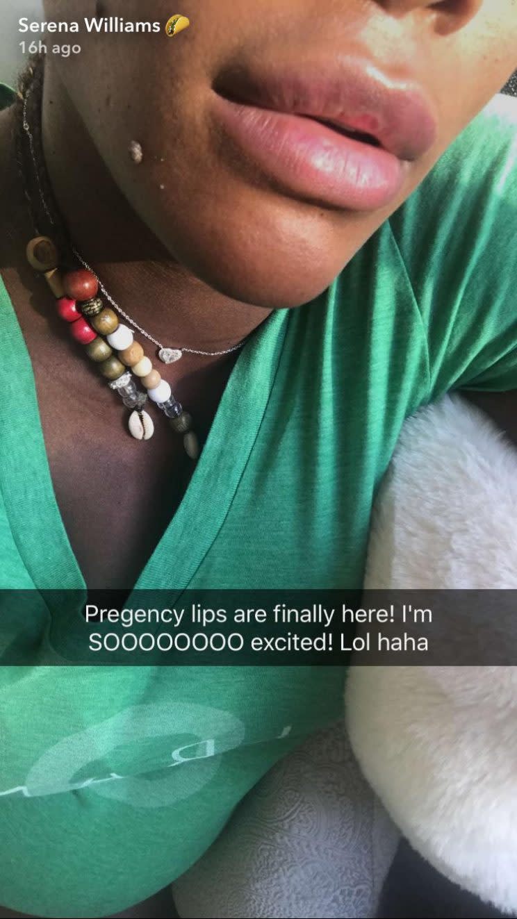 serena williams pregnancy lips