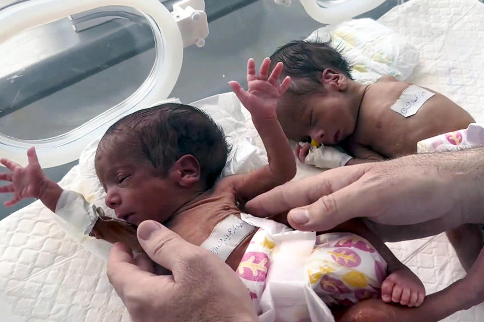 premature babies underweight small baby malnourished (NBC News)