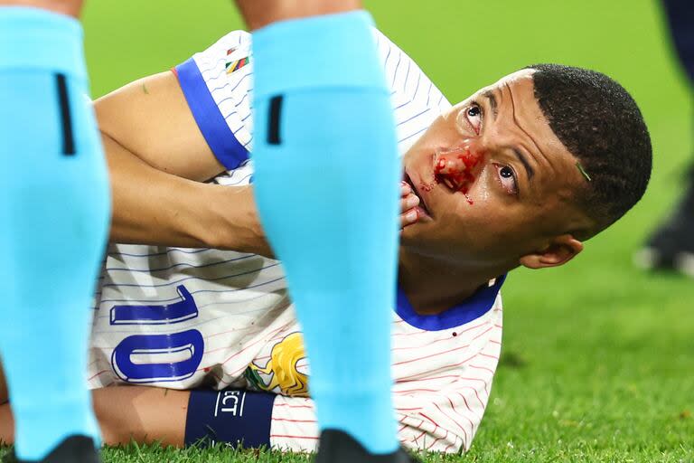  Kylian Mbappe de Francia cae con una hemorragia nasal durante el partido de la fase de grupos de la UEFA EURO 2024 entre Austria y Francia en el D¸sseldorf Arena el 17 de junio de 2024 en Dusseldorf, Alemania.