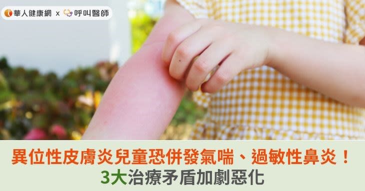 異位性皮膚炎兒童恐併發氣喘、過敏性鼻炎！3大治療矛盾加劇惡化