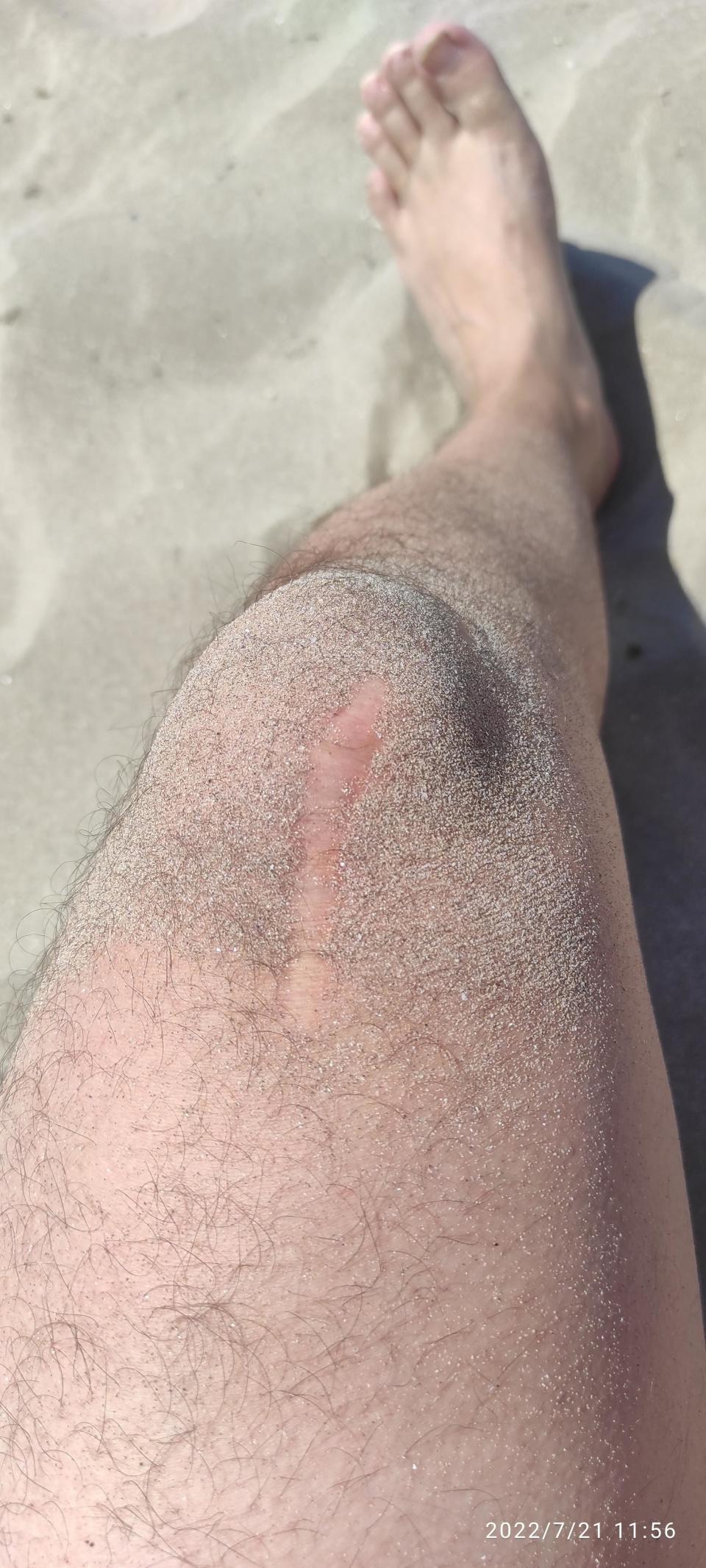 A person's leg covered in sand