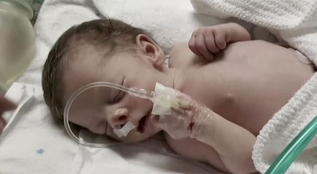 Sofia was suffering a life-threatening birth defect. Source: Today Tonight