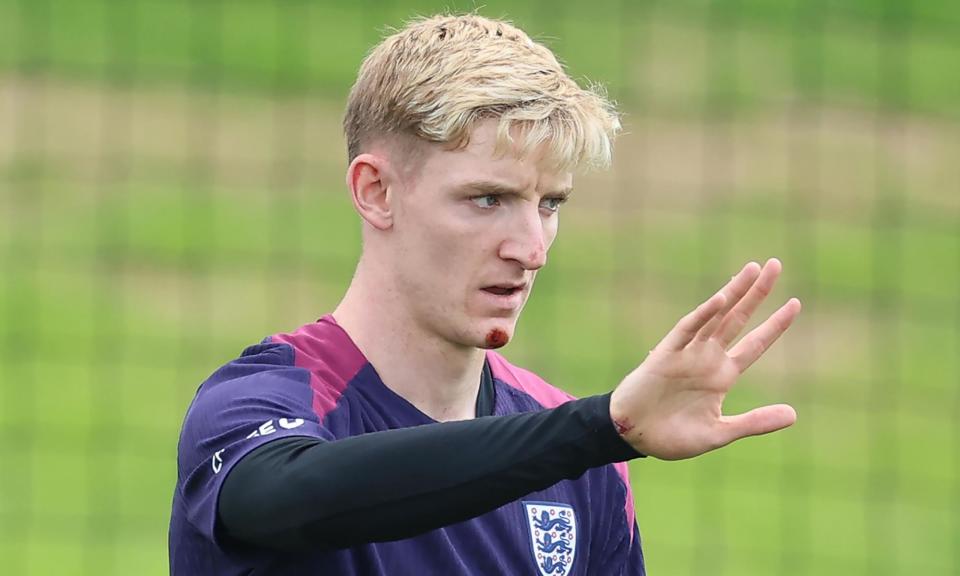 <span>The cuts to Anthony Gordon’s face and right wrist are visible at England training.</span><span>Photograph: Richard Pelham/Getty Images</span>