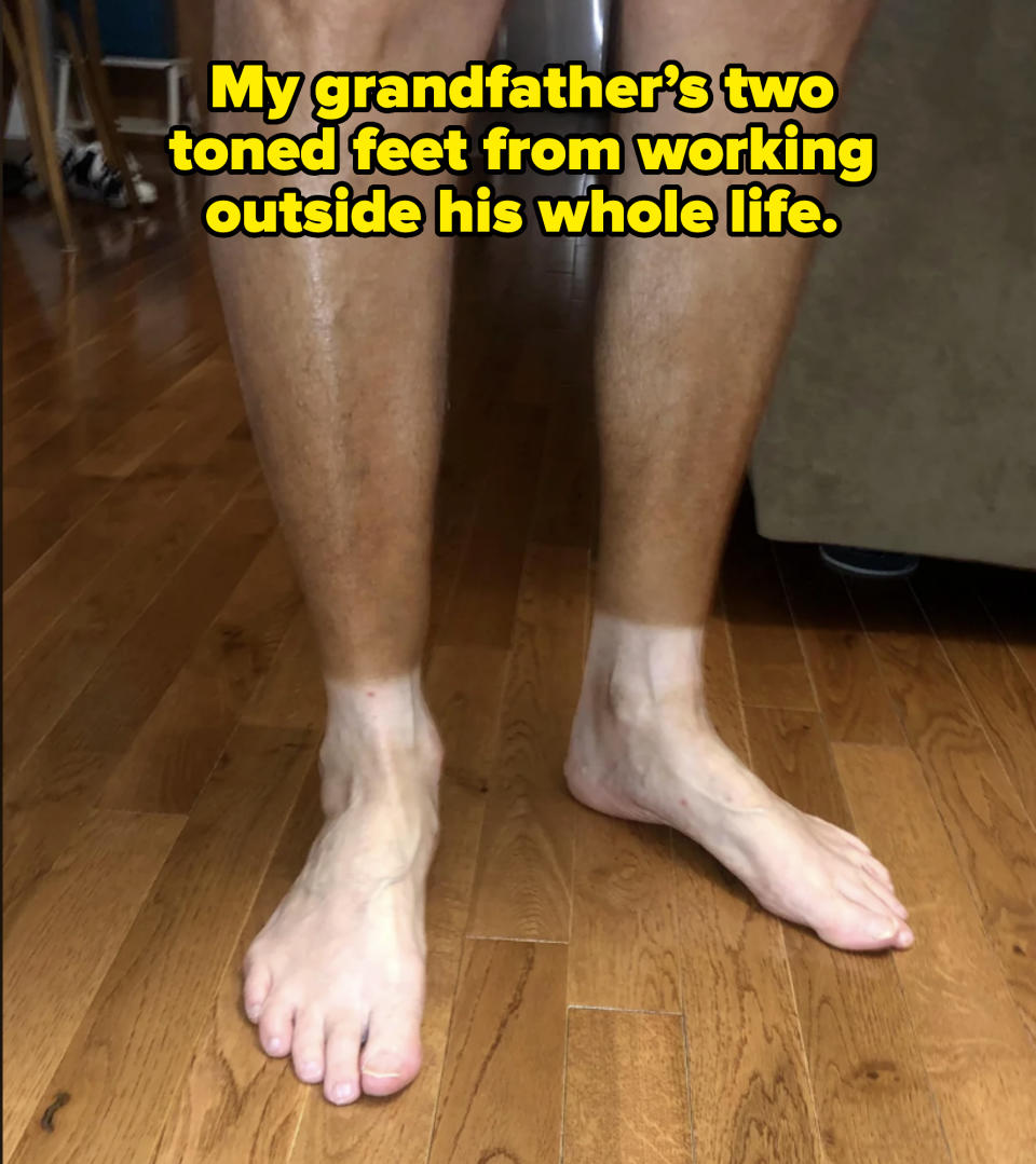 A person's legs and feet displaying a significant tan line, with the lower legs being much darker than the feet