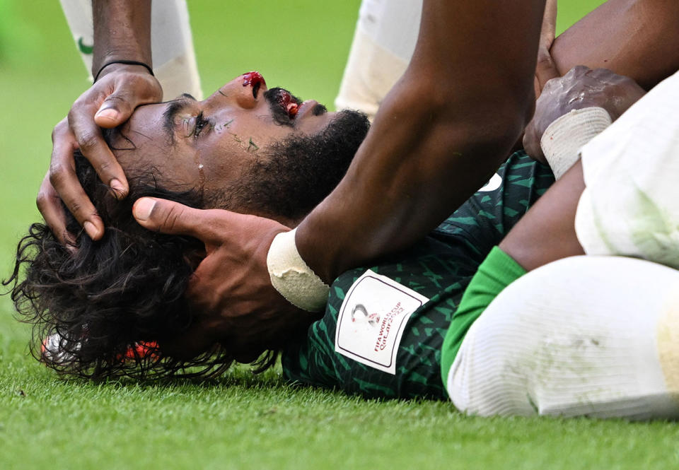 Yasser Al-Shahrani, pictured here receiving medical attention during Saudi Arabia's clash with Argentina at the World Cup.