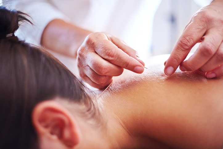 Acupuncture helps me cope with anxiety, so I asked an acupuncturist to explain why