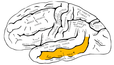 Diagram of brain with the middle temporal gyrus — a strip on the bottom side of the brain — highlighted in yellow