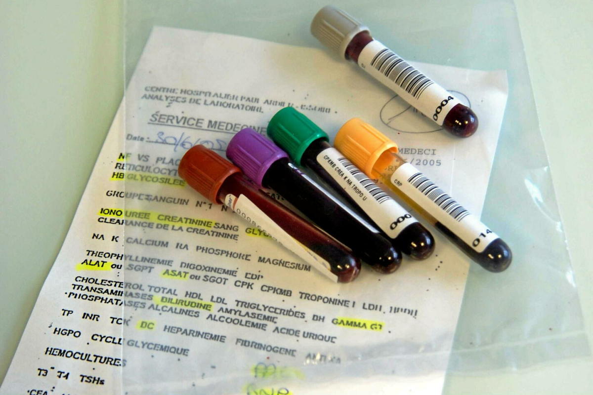 How to correctly interpret blood test results