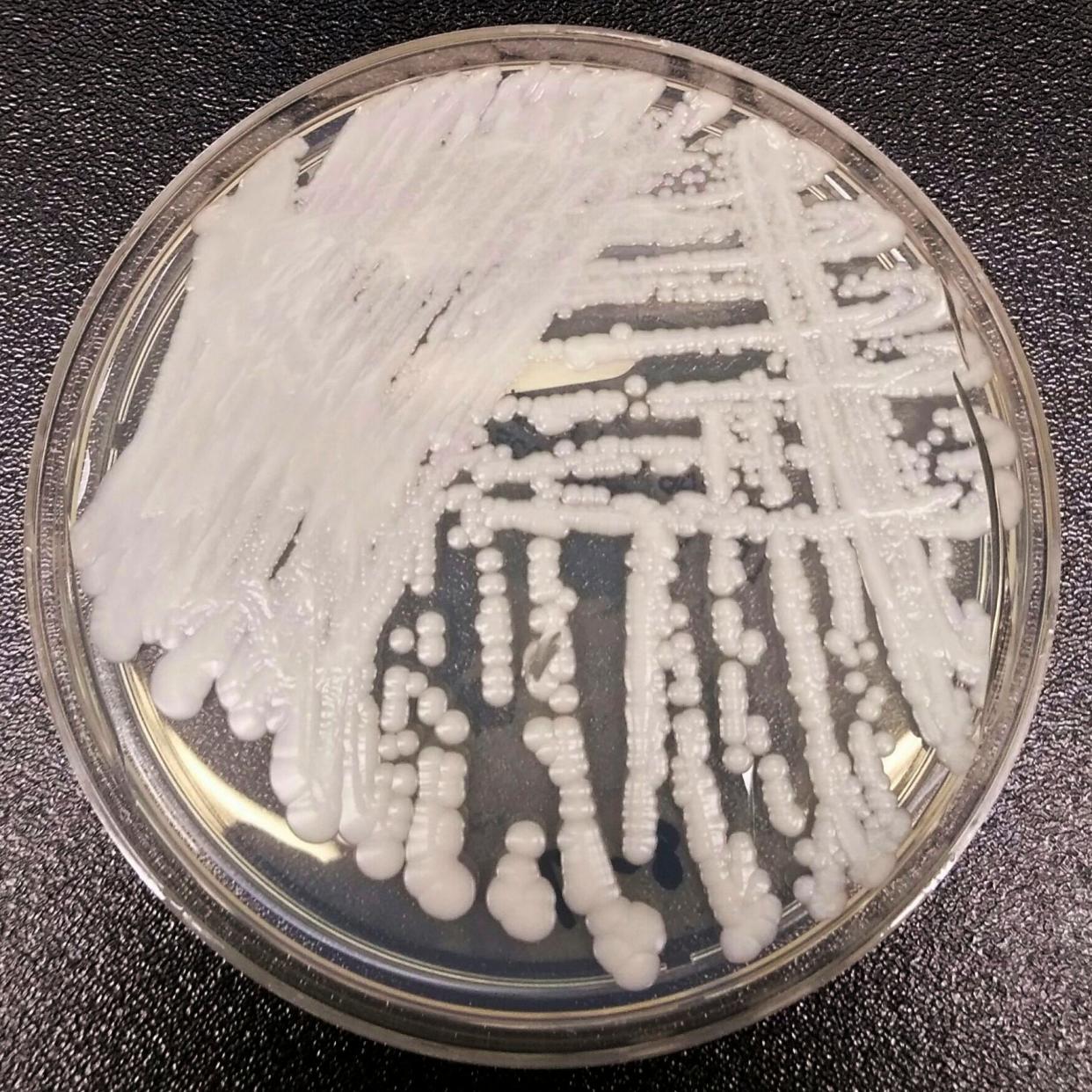 A strain of Candida auris cultured in a petri dish at a CDC laboratory (AP)