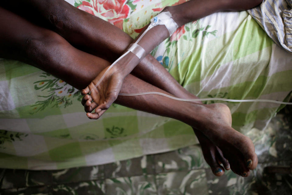 <p>A boy rests his arm on his mother’s legs as he receives treatment for cholera after Hurricane Matthew in the Hospital of Les Anglais, Haiti, October 10, 2016. (Andres Martinez Casares/Reuters)</p>