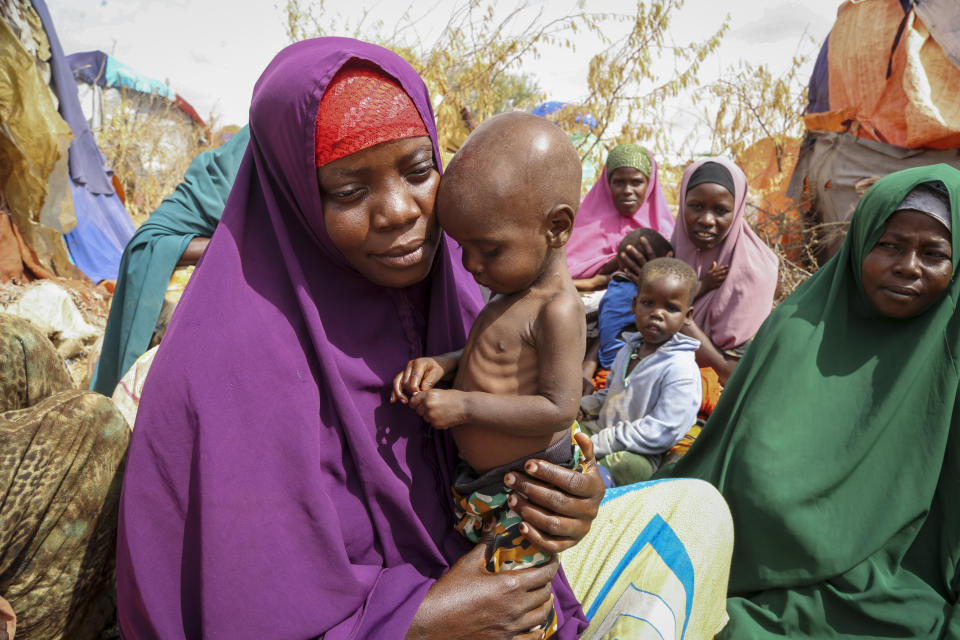FILE - Nunay Mohamed, 25, who fled the drought-stricken Lower Shabelle area, holds her one-year old malnourished child at a makeshift camp for the displaced on the outskirts of Mogadishu, Somalia Thursday, June 30, 2022. Russia’s war in Ukraine has affected millions of impoverished people who are going hungry in Africa, the Middle East and parts of Asia. The Razoni, loaded up with 26,000 tons of corn, is the first cargo ship to leave Ukraine since the Russian invasion, and set sail from Odesa Monday, August 1, 2022. Its final destination is Lebanon, with estimated arrival date on Saturday, Aug. 6, 2022. (AP Photo/Farah Abdi Warsameh, File)