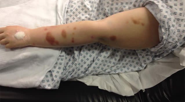 Her mother is calling for justice after she was left battered. Source: Facebook/ Claire Nossiter