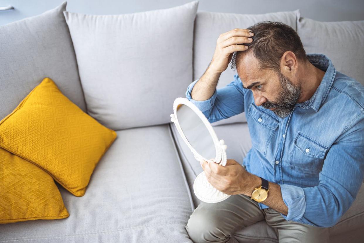 hair loss men with mirror