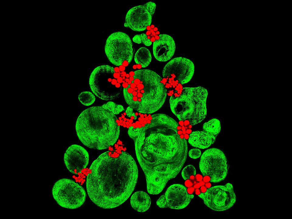 Kakteen, Wassermelonen oder doch Weihnachtsbäume? Falsch! Dem Betrachter wird ein knorpelähnliches Gewebe präsentiert, das gerade aus Stammzellen heranwächst. Das Kollagen leuchtet in Grün und die Fettablagerungen in Rot. (Bild-Copyright: Caters News Agency)
