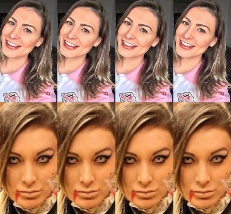 Andressa Urach Posta Novo Antes E Depois E Choca Internautas