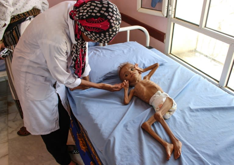 Save the Children says disruption to supplies coming through Yemen's embattled Hodeida port has put an extra one million children at risk of starvation, bringing the total to 5.2 million